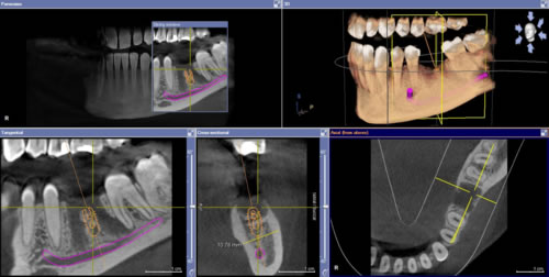Superior 3D X-Ray images